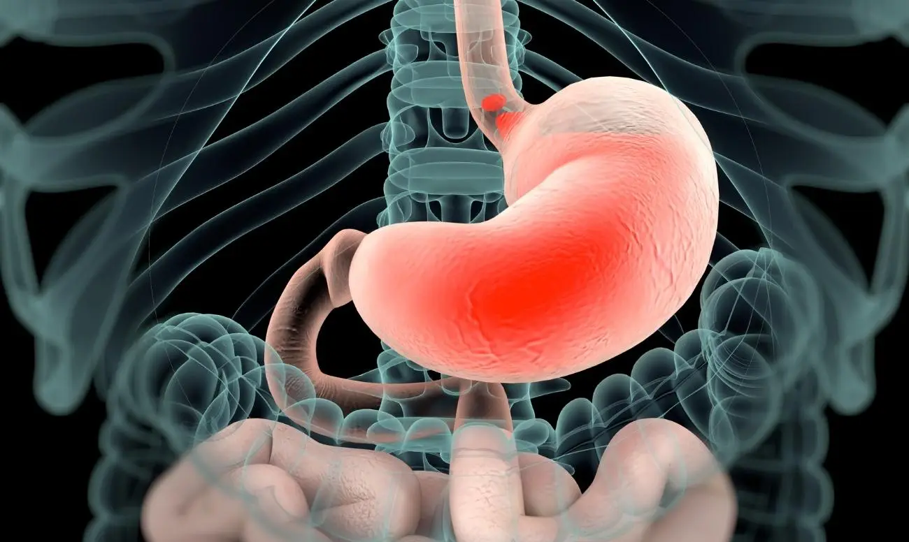 Sospetti un’infezione allo stomaco? Ecco l’esame del sangue che può rilevare l’helicobacter