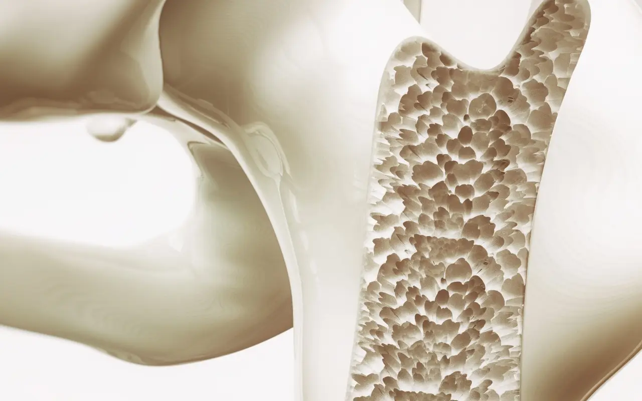 Ossa fragili? Mangia questi 5 alimenti ogni giorno per invertire l’osteoporosi naturalmente